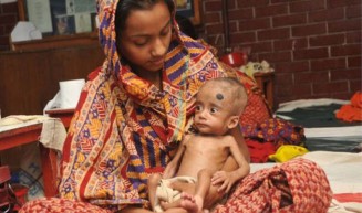 অপুষ্টিতে ভোগা আপনার শিশুকে যা খাওয়াবেন